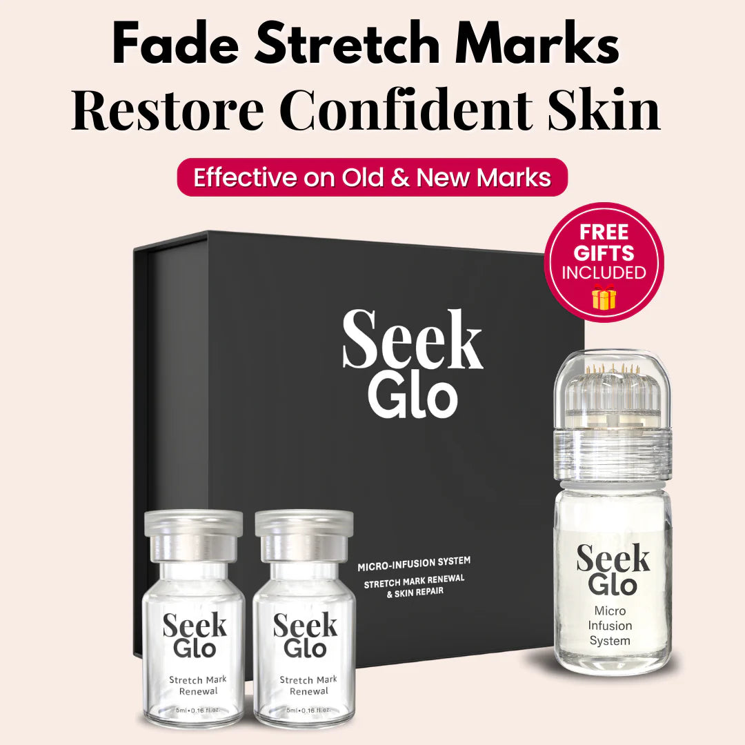 SeekGlo’s Stretch Mark System
